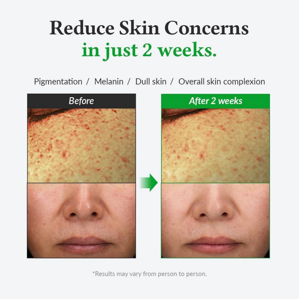 dr.althea, gentle vitamin c serum 30ml - Asian Hera