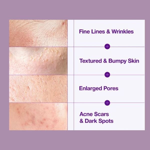 anua retinol 0.3% + niacin renweing serum 30 ml - Asian Hera